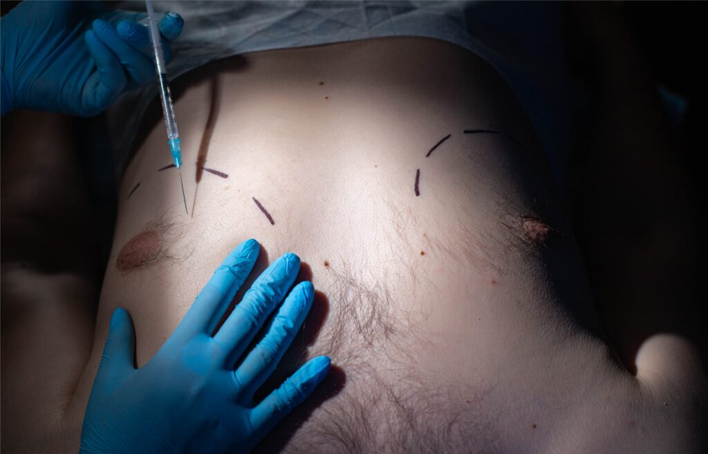 a person with blue gloves and a needle on their stomach.